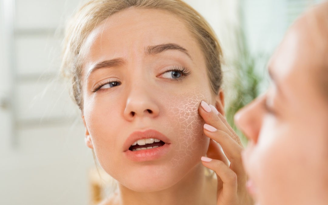 Read more about the article Knowing Your Skin: Dry or Dehydrated?