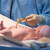 How Safe and Simple Is Cord Tissue Stem Cell Collection? A Parent’s Guide