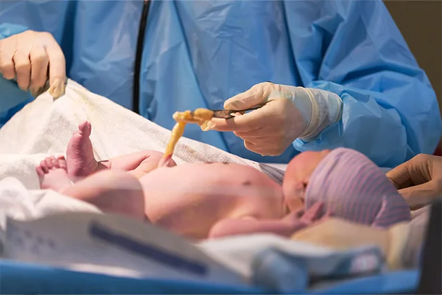 How Safe and Simple Is Cord Tissue Stem Cell Collection? A Parent’s Guide