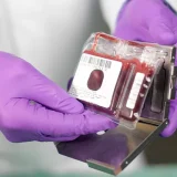 Is Cord Blood Banking Right for Your Family? Take Our Quiz