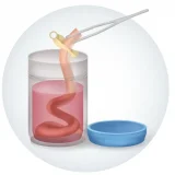 Cord Tissue Stem Cells: Benefits, Myths & Real Medical Uses